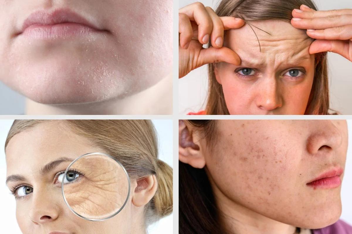 Lão hóa sớm không phải do tuổi – Mà do “tích độc tế bào”