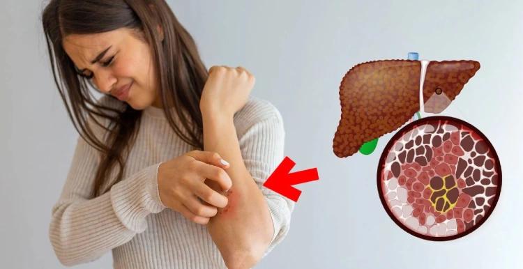 Gan thường xuyên phải làm việc như thế nào? Dấu hiệu gan cần được chăm sóc